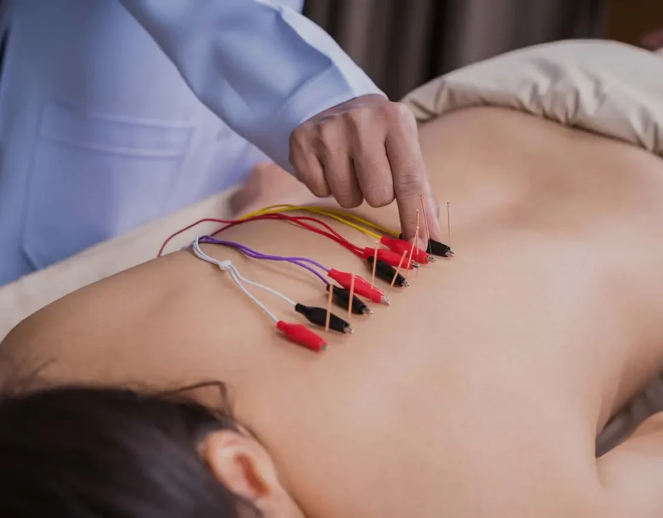 Fisio Invasiva acupuntura clinica