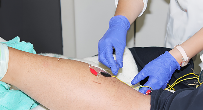 Acupuntura clínica 7 Fisio Invasiva acupuntura clinica izq